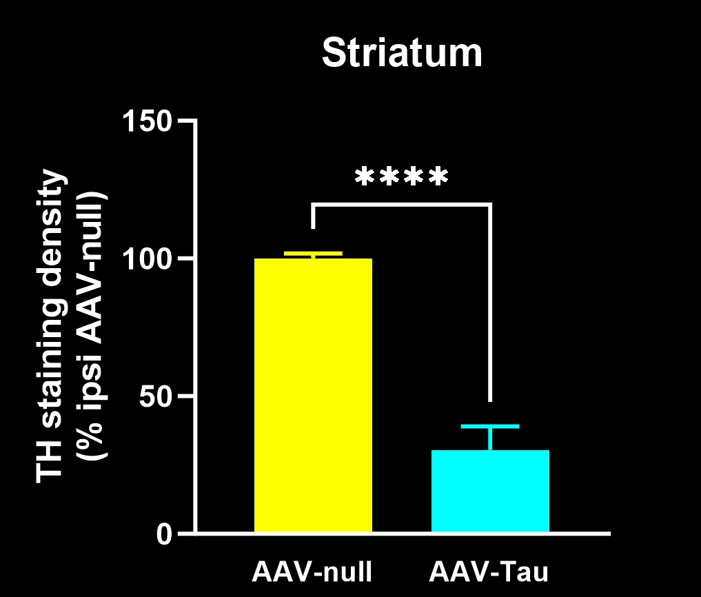 Tyrosine Hydroxylase Staining in the Caudate-Putamen