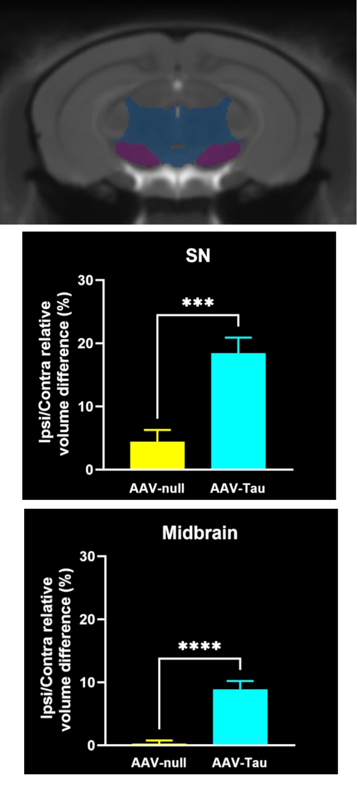 MRI Brain Atlas and Volume Data for the SNc Level