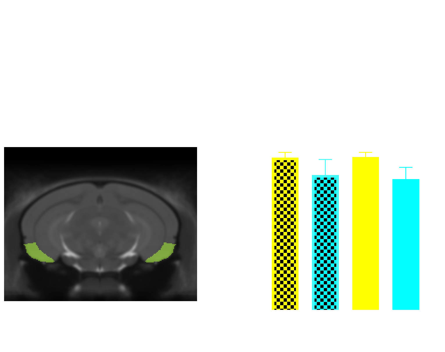 MRI Atlas and Regional Volume in entorhinal cortex