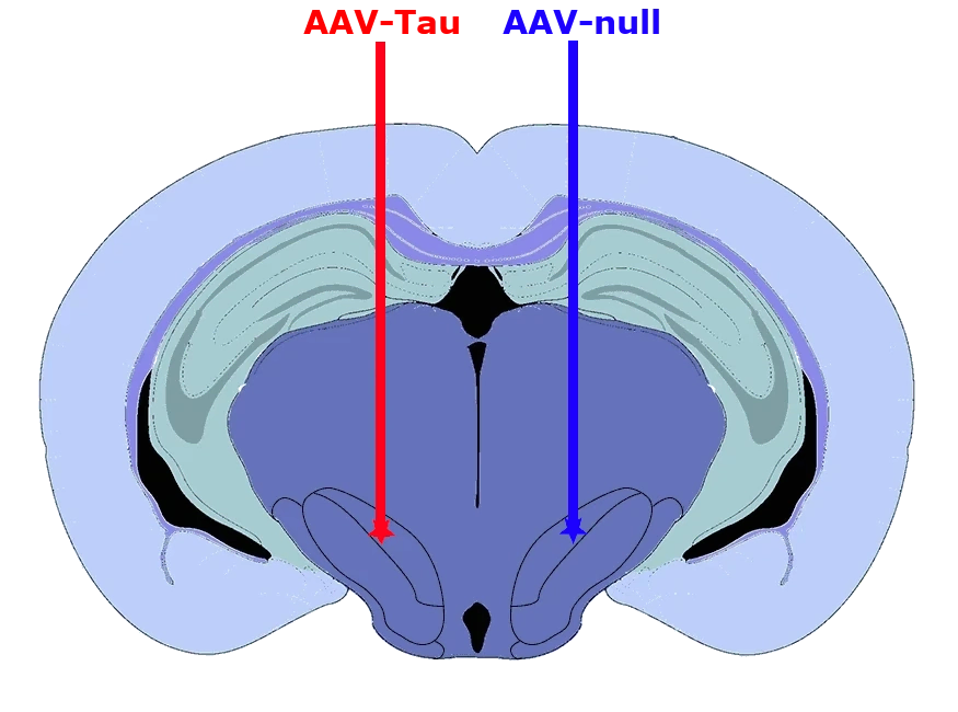 Coronal Atlas with AAV Injection Site