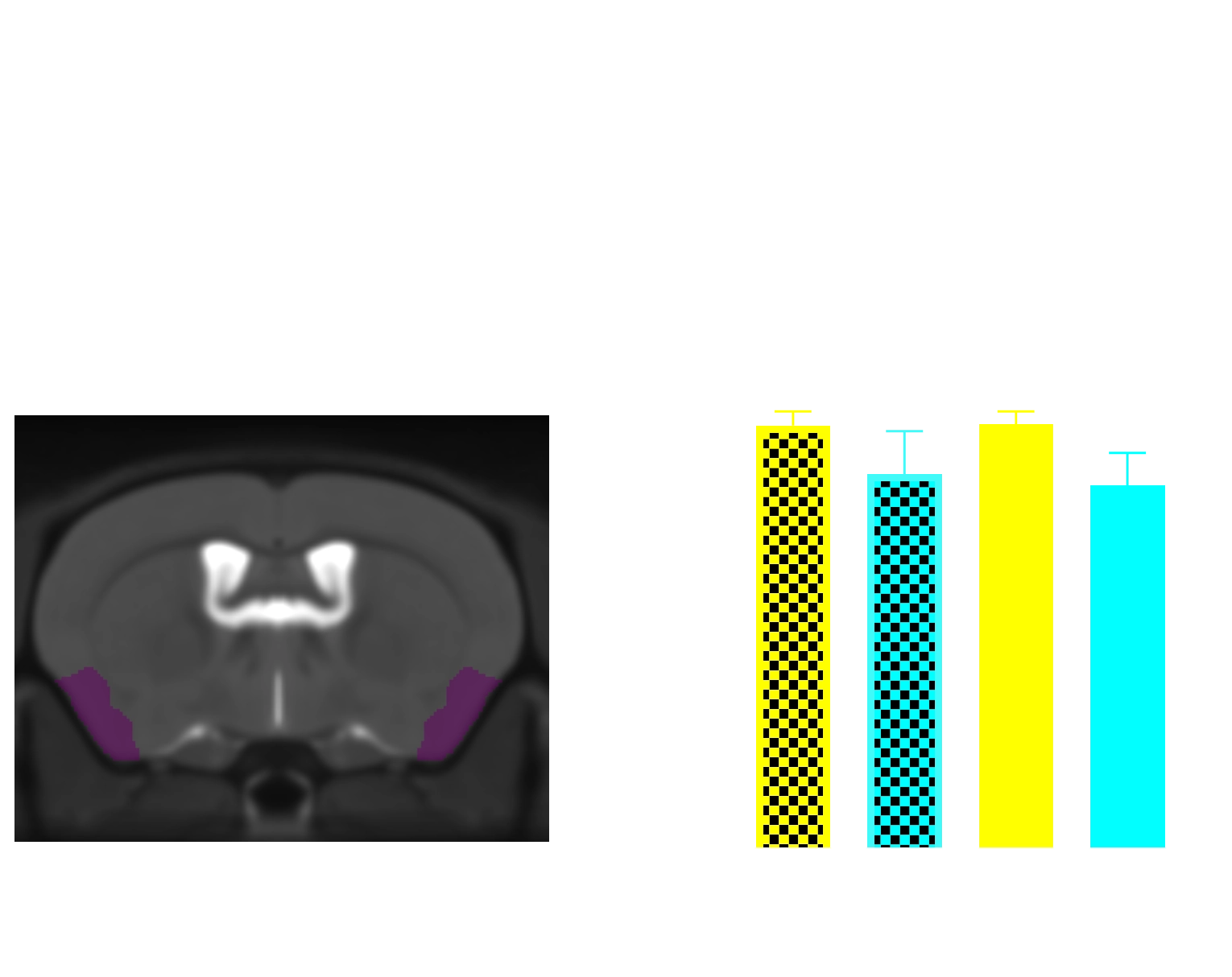 MRI Atlas and Regional Volume in piriform cortex